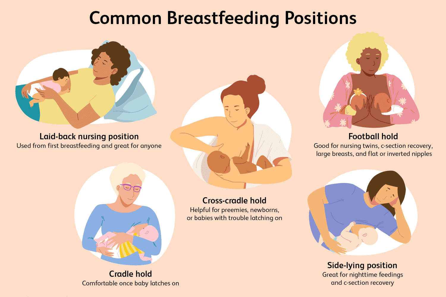 Common breastfeeding positions include the cradle, cross-cradle, football, laid back and side-lying position.